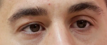 image.png.ee0dc5a5e6b64f71316eebfc72eed8be.png
